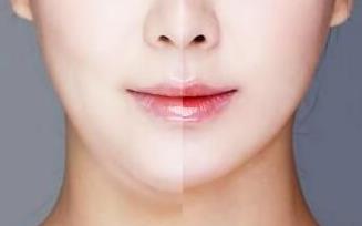 連云港中醫(yī)院醫(yī)療燒傷整形外科科室是做哪些整容項目的