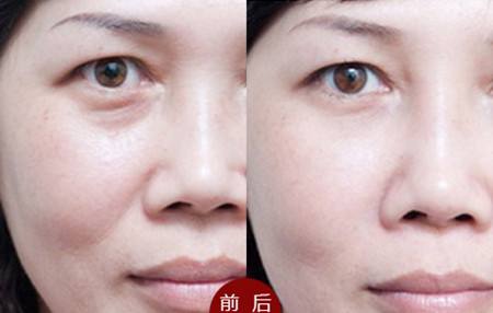 菏澤鼻部修復(fù)需要去哪家醫(yī)院才可信賴？好的醫(yī)療機(jī)構(gòu)有哪些？