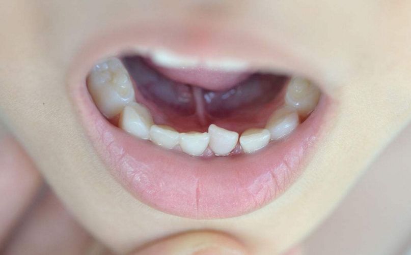 金范整容了嗎？價值提升的背后秘密揭示！