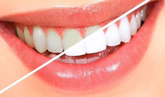 淄博哪家醫(yī)療美容機構的瘦臉針效果最好，受用戶好評最多？