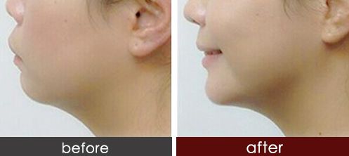 錦州哪家醫(yī)院做激光祛斑好？解密錦州專業(yè)的激光祛斑技術(shù)與經(jīng)驗(yàn)！