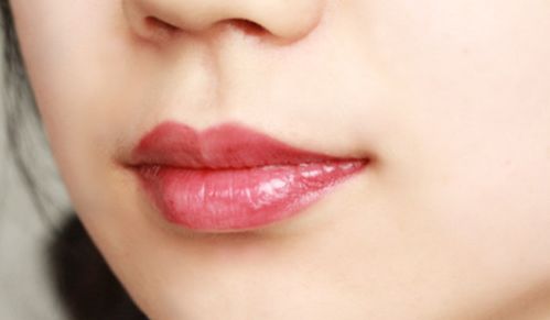 重慶做肋骨鼻哪家醫(yī)院好？解析最佳醫(yī)療機(jī)構(gòu)及選擇要點(diǎn)！