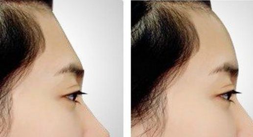 寧波市整形外科醫(yī)院哪家好，專家推薦的整容醫(yī)院排行榜