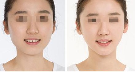 廣州做私密手術(shù)哪家醫(yī)院好，選擇哪家醫(yī)院最合適