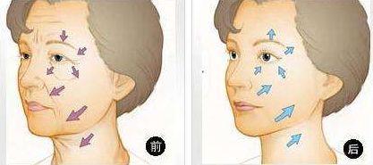 全球領(lǐng)先植發(fā)醫(yī)院盛傳！2023獨(dú)家揭曉！雍禾、新生等傲視同行！