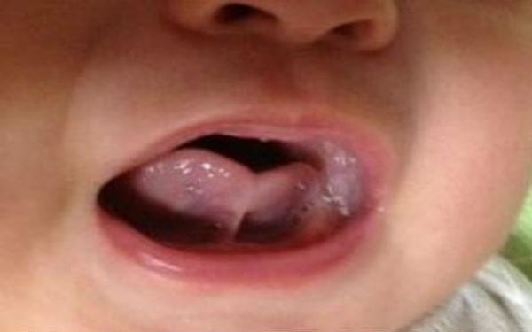 2023中國切除祛川字紋排名前十強(qiáng)整形美容醫(yī)院曝光！這些醫(yī)院的整形效果讓你驚艷躍然紙上！