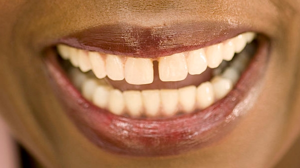 2023長(zhǎng)春雙下巴除皺醫(yī)療美容醫(yī)院推薦！這些家值得關(guān)注！