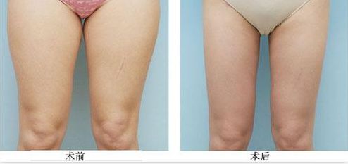 成都眼部美容哪家好且價格公正實惠？