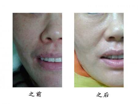 西寧市第三人民醫(yī)院燒傷科口碑如何？值得信賴嗎？醫(yī)院中的專家醫(yī)生有哪些？