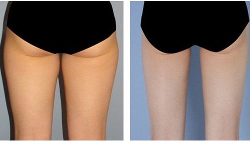 阿朵整容了嗎？揭秘明星整容真相！