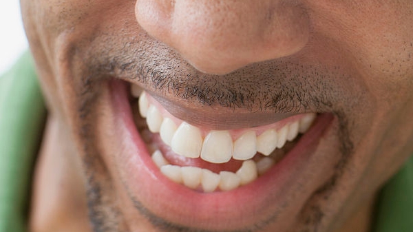 M型輕量級植發(fā)真的可以解決型男脫發(fā)問題嗎？如何實現(xiàn)持久性成果？