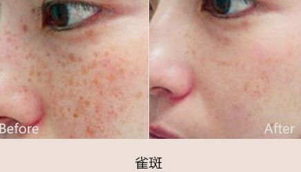 鎮(zhèn)江哪家醫(yī)院做雙眼皮手術(shù)好？詳細(xì)比較分析，推薦最佳項(xiàng)