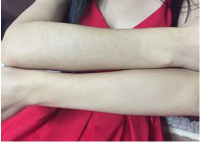 沈陽雙眼皮修復(fù)哪家好專家推薦修復(fù)雙眼皮技術(shù)高超牌醫(yī)院