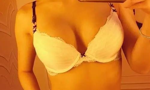 阿雅整容了嗎？揭秘她的美麗變身秘籍！