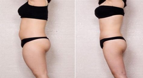 深圳祛痘坑醫(yī)院哪家好？揭秘市區(qū)五家痘疤修復?？浦行?></div>
                            <div   id=