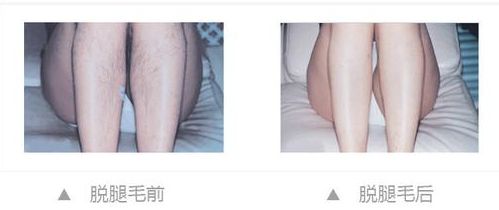 揭秘江陰激光祛斑哪家醫(yī)院好，專家解答告訴你最靠譜的醫(yī)院