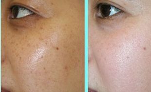 沈陽做鼻子哪家整容醫(yī)院好？解答五大沈陽整形醫(yī)院推薦排行