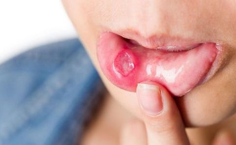 杭州哪家醫(yī)院治附耳好？附耳就醫(yī)攻略精選！