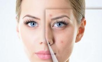 德州割包皮醫(yī)院哪家好？選擇正規(guī)醫(yī)院，了解手術(shù)流程和費(fèi)用