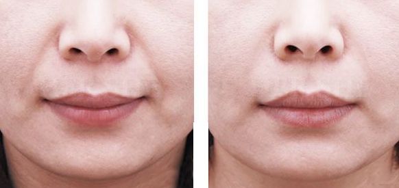 上海美容整形醫(yī)院排名2023年哪家最靠譜？