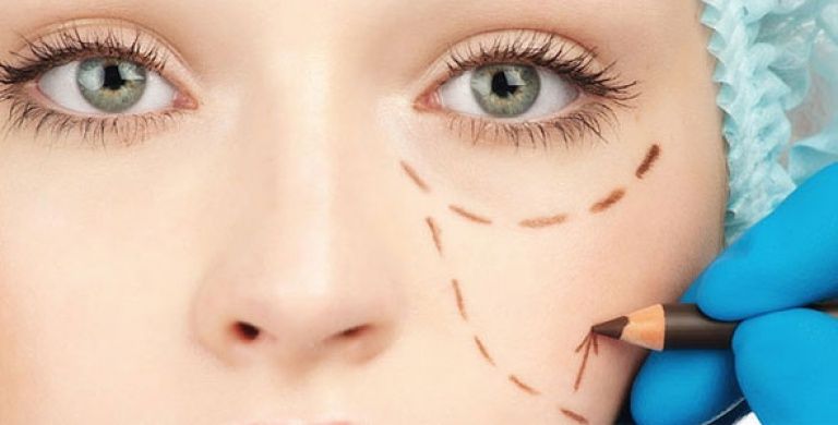 哪家成都做假體隆鼻效果好？