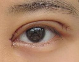 陳笠笠是否真的做過(guò)整容？揭秘其容貌變化背后的真相