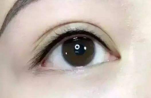 超聲吸脂減肥手術(shù)，能否持久塑身？減肥后需注意哪些事項(xiàng)？