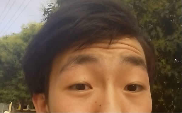 50歲的面部提升有哪些好方法？效果能持續(xù)多久呢？