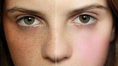 長沙值得推薦的高評價手術(shù)除皺整形醫(yī)院有哪些？2023年長沙市排名前10強(qiáng)的權(quán)威整形醫(yī)院排行榜公布！