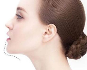 重慶唇紋去除手術(shù)醫(yī)院優(yōu)質(zhì)推薦！2023年性?xún)r(jià)比高的有哪些？享有聲譽(yù)的10家整形醫(yī)院綜合解析！