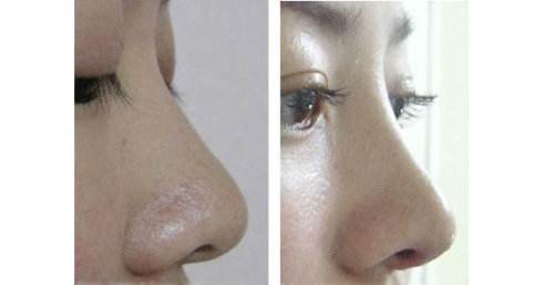 穎兒瘦身秘技：奇跡般的身材變化？