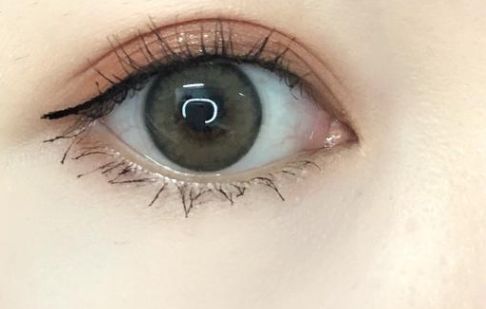 2023年比較好的烏魯木齊激光祛斑心得分享