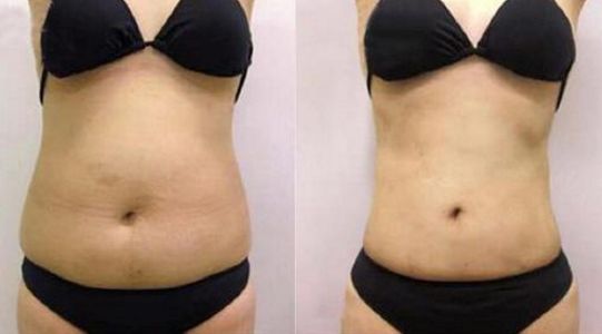 濟南比較好的微整形醫(yī)院2023全面解析