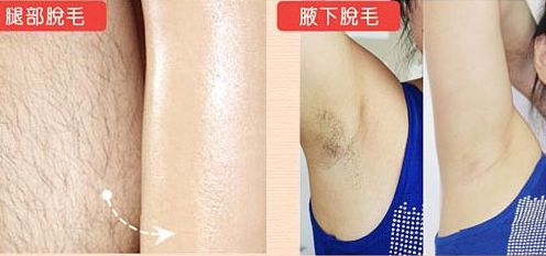 廈門副乳哪家醫(yī)院好？專家推薦最受用戶青睞的廈門醫(yī)院