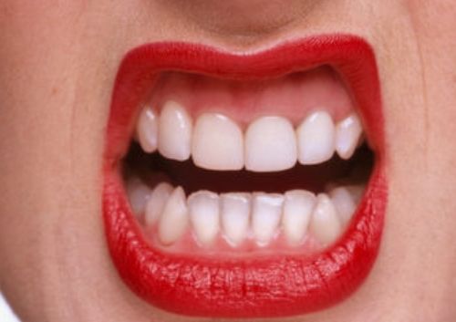 上海磨顴骨哪家醫(yī)院好？揭秘2023年最受歡迎的磨顴骨醫(yī)療機構(gòu)