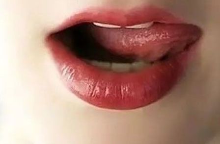 武漢哪家醫(yī)院能有效去除皮膚斑點(diǎn)？