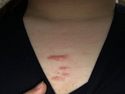 惠州中京醫(yī)院真的靠譜嗎？是一家值得信賴的整形醫(yī)院嗎？