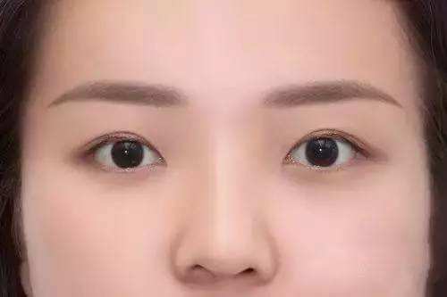 2023年鄭州臉部皺紋修復(fù)醫(yī)院綜合排行榜大揭曉，你知道都有哪些嗎？