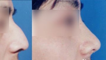 南京醫(yī)院熱瑪吉推薦，10家權(quán)威醫(yī)療機(jī)構(gòu)抗衰技術(shù)PK，勝算高！