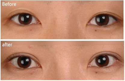 徐州市哪家醫(yī)院祛痘效果好？排名前列的徐州市專業(yè)祛痘醫(yī)院有哪些？