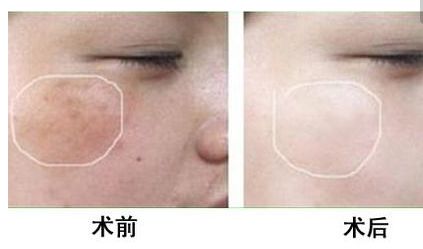 韓國整容潮流：年輕人的美容方式亮眼嗎？