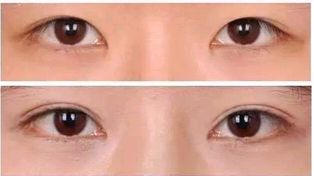 天津整容醫(yī)院推薦-專業(yè)技術與良好口碑，靠譜名單分享