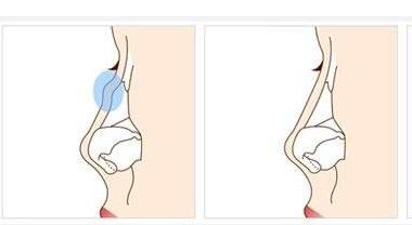 揚(yáng)州眼部手術(shù)中心：完美修復(fù)雙眼皮，經(jīng)典技術(shù)解決眼部問(wèn)題