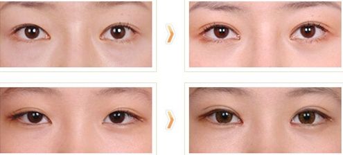 包頭哪家美容手術(shù)醫(yī)院好評(píng)如潮，專(zhuān)家為您推薦！