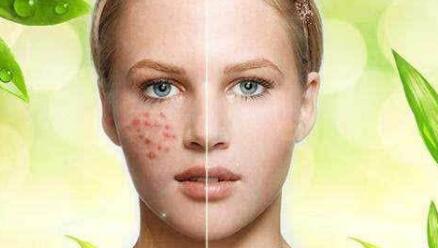 植發(fā)手術：5000塊能實現(xiàn)頭發(fā)再生嗎？恢復需要多長時間？