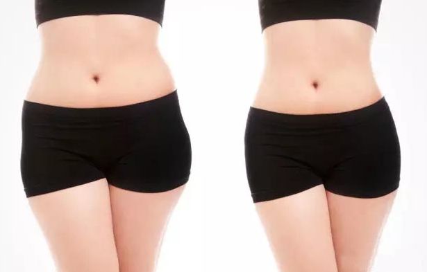 松原修復(fù)雙眼皮哪家好？一文了解松原市雙眼皮修復(fù)機(jī)構(gòu)排名