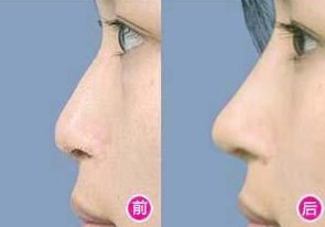 深圳哪家醫(yī)院是拉皮專家？專業(yè)的整形醫(yī)院名單！