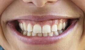 深圳那家醫(yī)院治療痤瘡的彩光嫩膚效果好？2023排名前10的整形醫(yī)院對(duì)比！