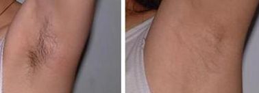 南寧微整正規(guī)醫(yī)院哪家好？揭秘南寧當?shù)乜诒詈玫奈⒄吾t(yī)院！