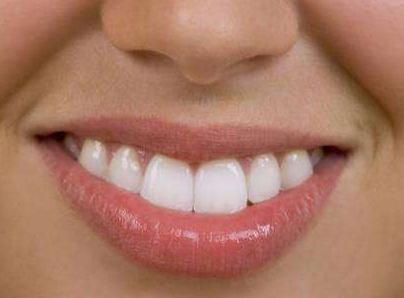 環(huán)形吸脂操作究竟有效嗎？如何實現(xiàn)手臂360°塑形術(shù)？